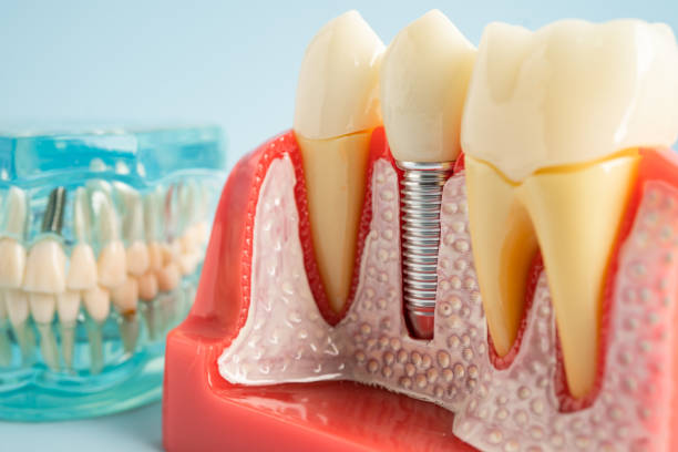 Our Range of Dental Services in Coalville, UT